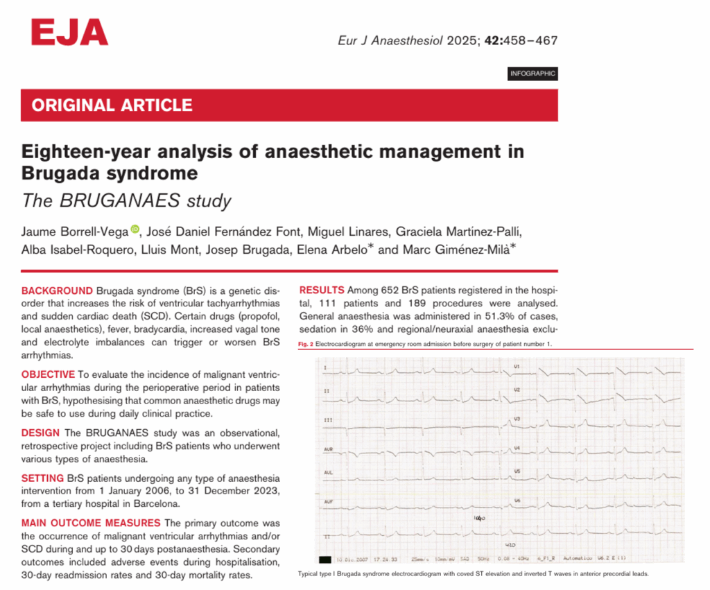 Anesthesia in Brugada Syndrome