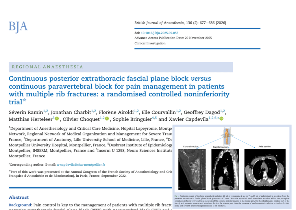 PEFB vs PVB for Rib Fractures