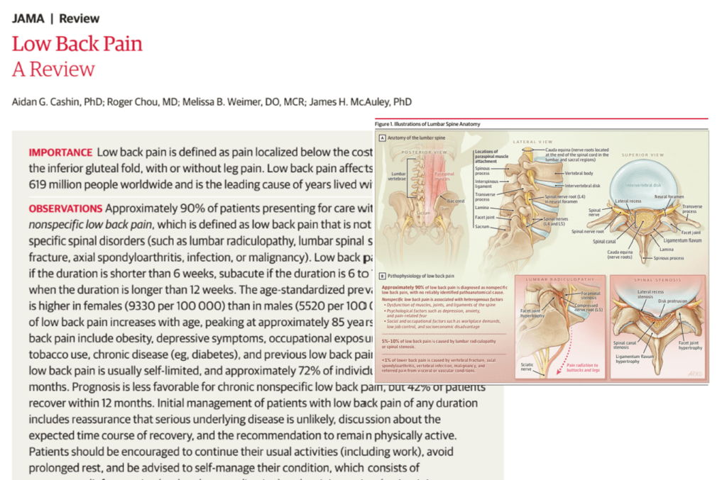 Low Back Pain