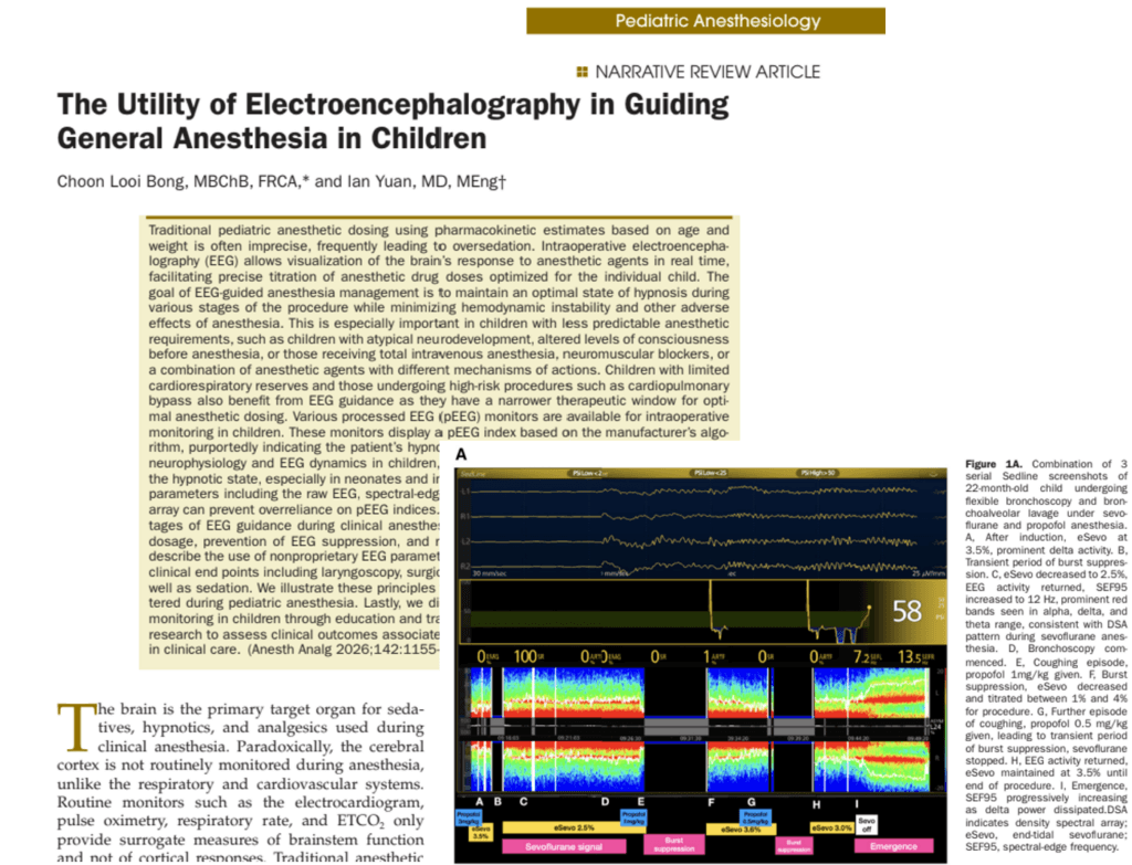 The Utility of Electroencephalography in Guiding General Anesthesia in Children