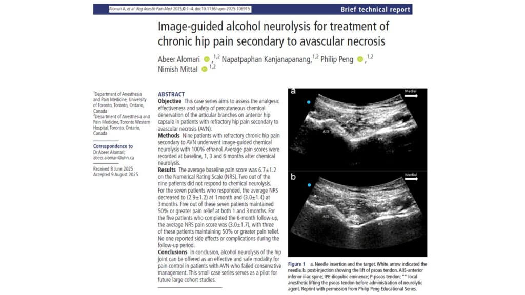 Image-guided alcohol neurolysis for refractory hip pain in avascular necrosis